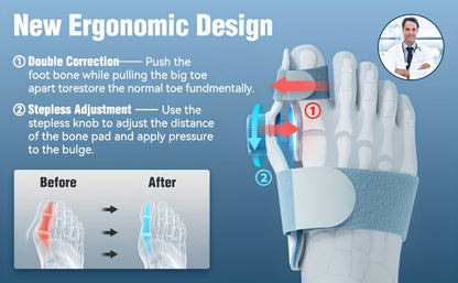 1pc TECH LOVE Adjustable Bunion Corrector for Men & Women, Double Correction Hammer Toe Straightener with Silicone Pad, Hand Washable Buckle Closure Bunion Splint Relief Separator